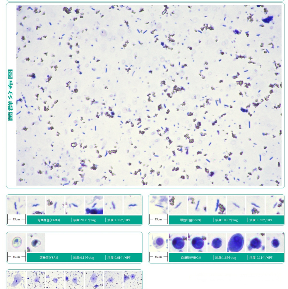 Fluorescence Immunoassay (2)